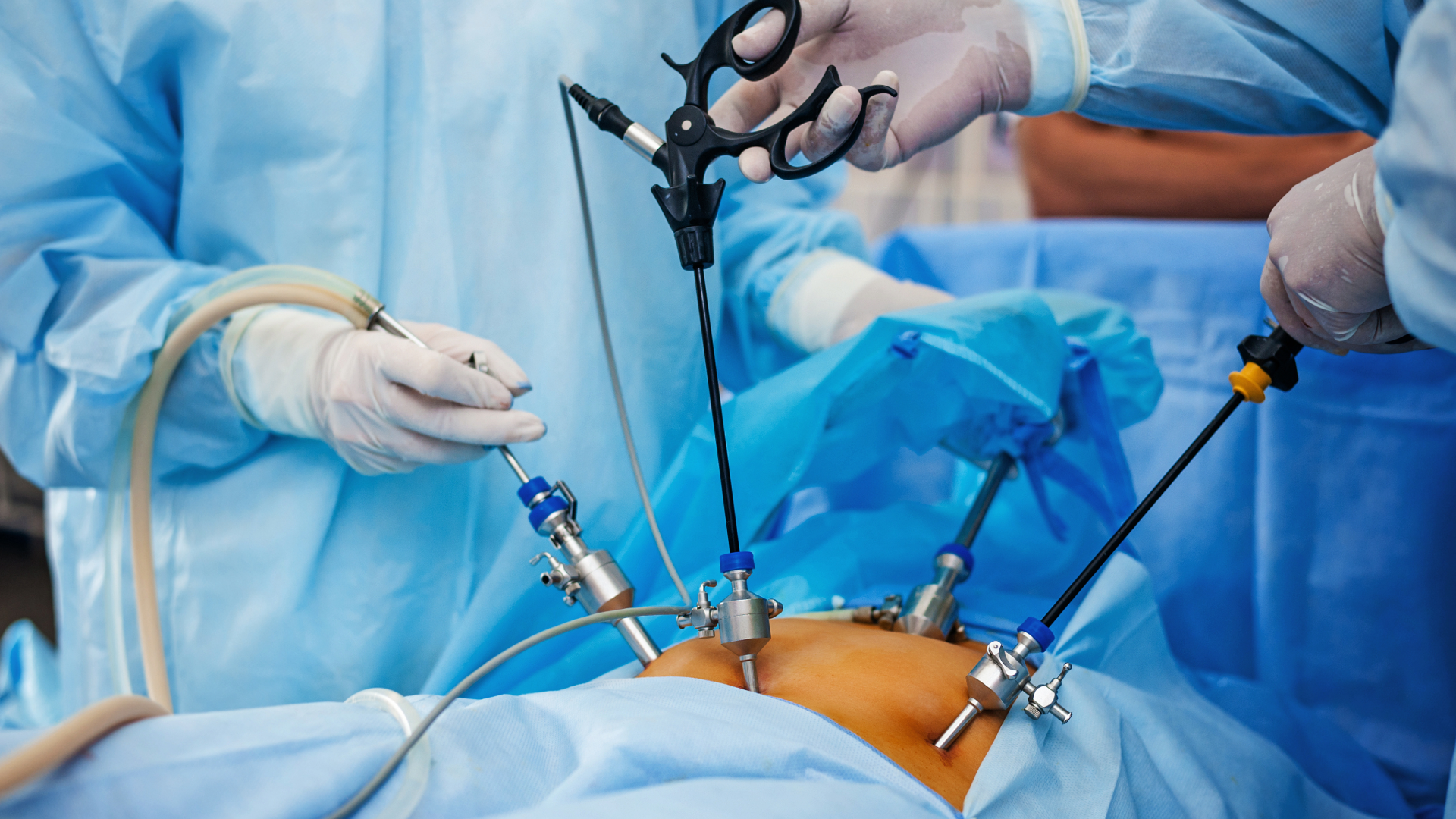 Laparoscopic surgery