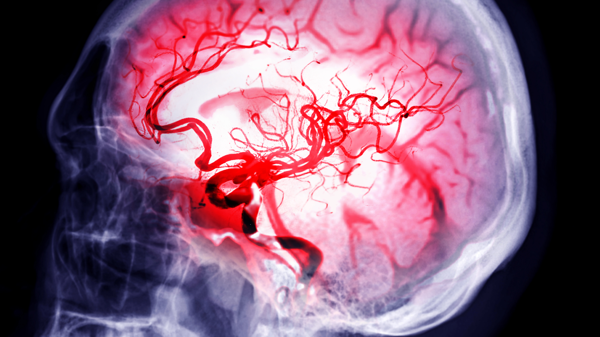 An image displaying the vascular anatomy of the brain.