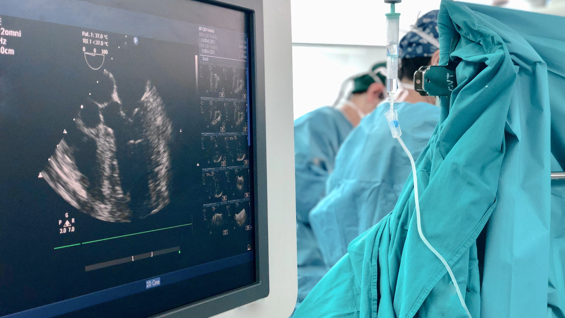 Transesophageal Echocardiogram