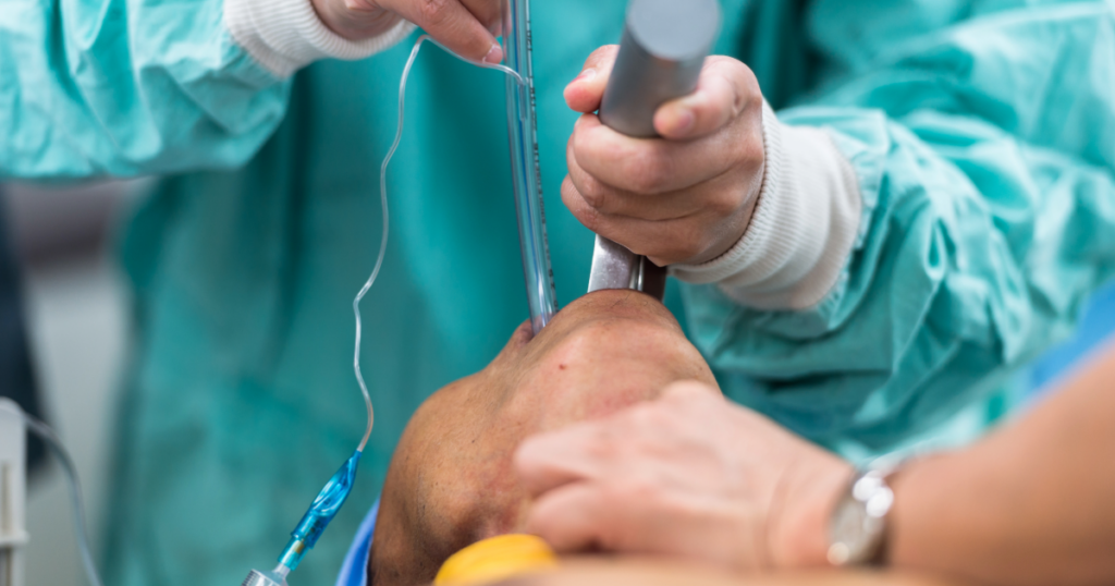 Esophageal Intubation in the Emergency Department: A Failed Airway and a Hypoxic Brain Injury | Paul Cahill Medical Malpractice Lawyer Notable case from Paul Cahill's practice: a 2015 wrongful death settlement involving an esophageal intubation in the emergency department that caused a hypoxic brain injury. By Paul Cahill, LSO Certified Specialist in Civil Litigation.